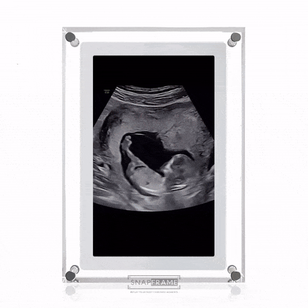 MyNestFrame™ Digitalrahmen